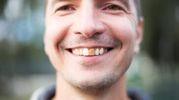 Dead Tooth