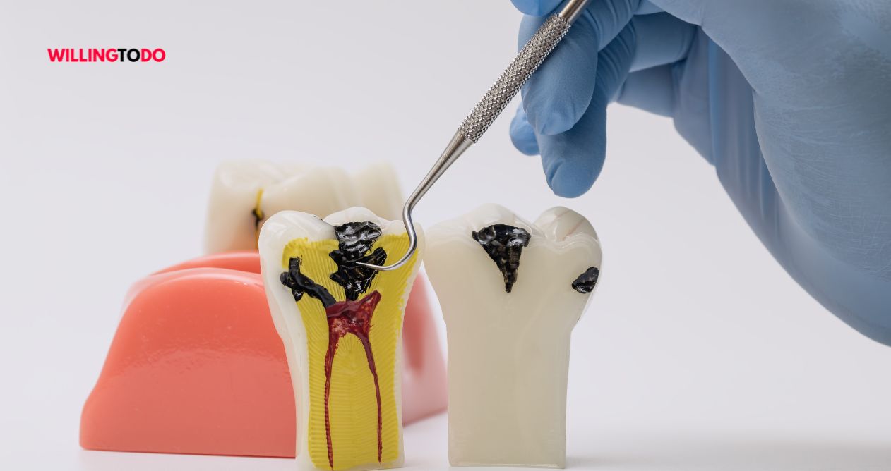 How Long Does Root Canal Take to Do