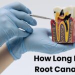 How Long Does a Root Canal Take