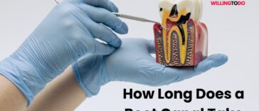 How Long Does a Root Canal Take