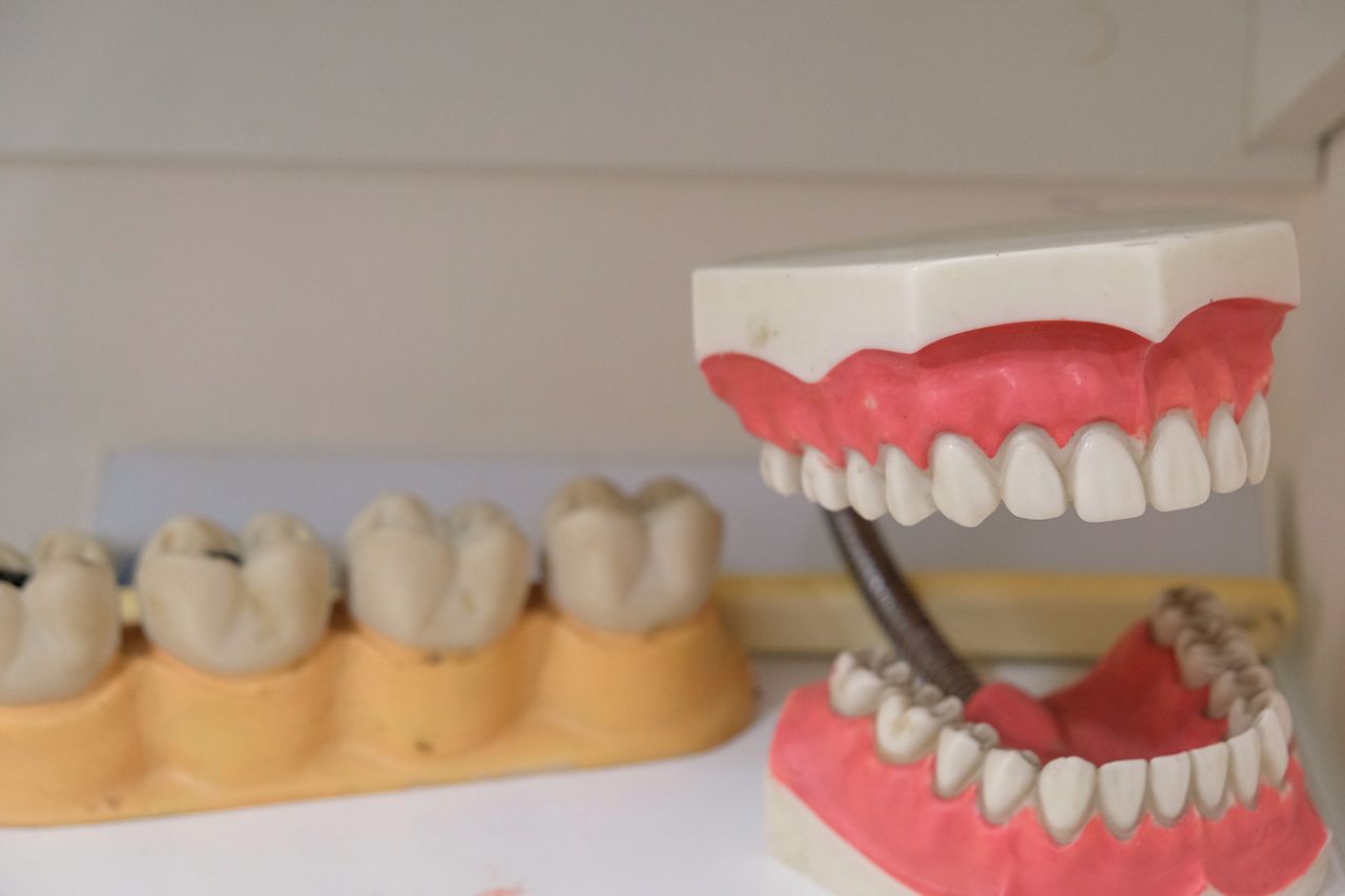 Impacts of Wisdom Teeth
