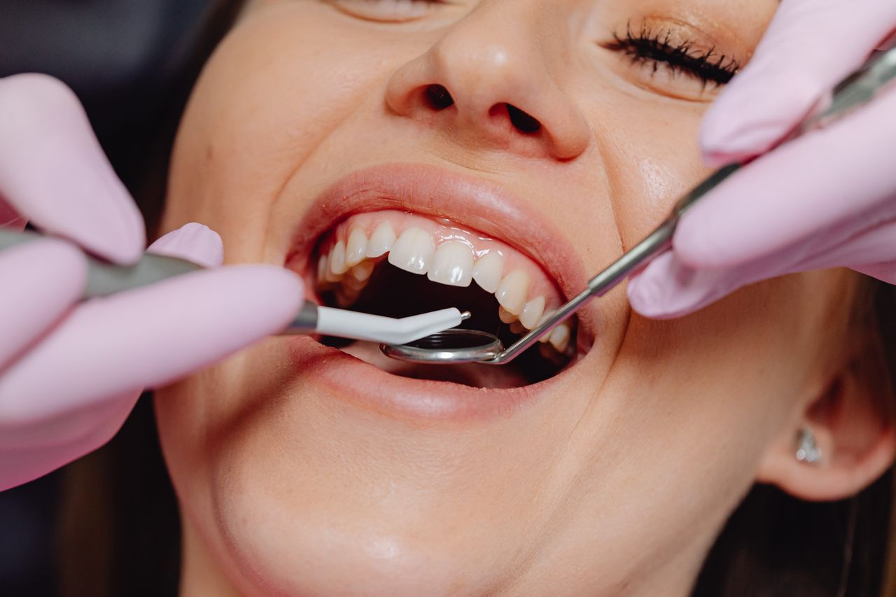 A close-up view of a periodontal probe being used to measure the depth of a gum pocket in a mouth.
