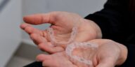 How to clean retainers