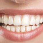 what does a cavity look like​