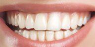 what does a cavity look like​