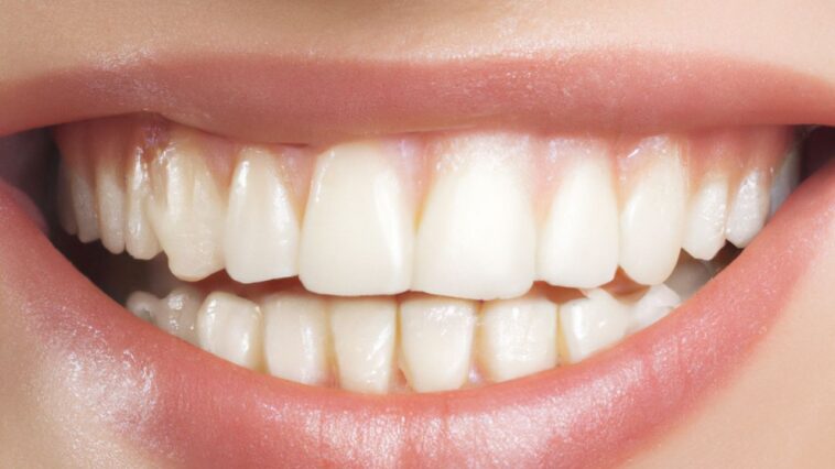 what does a cavity look like​